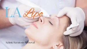 Woman receiving Actinic Keratosis Removal Treatment Wellingborough