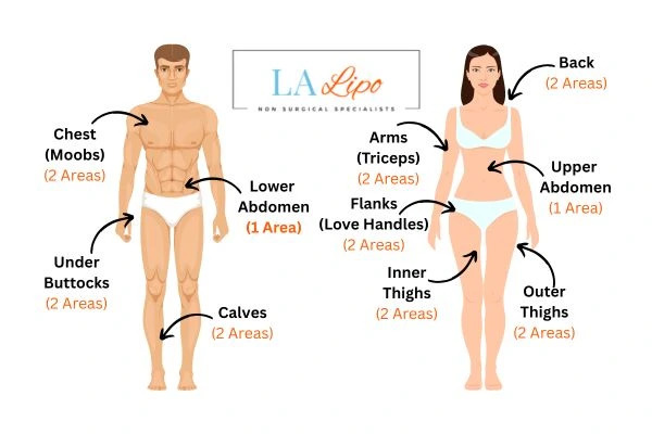 LA LIPO Cryolipolysis Areas Wellingborough