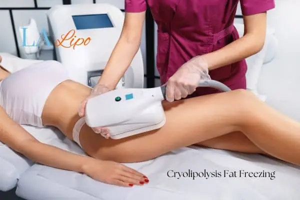 Woman receiving coolsculpting Wellingborough treatment on her thighs