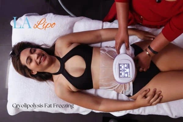 woman getting cryolipolysis Wellingborough