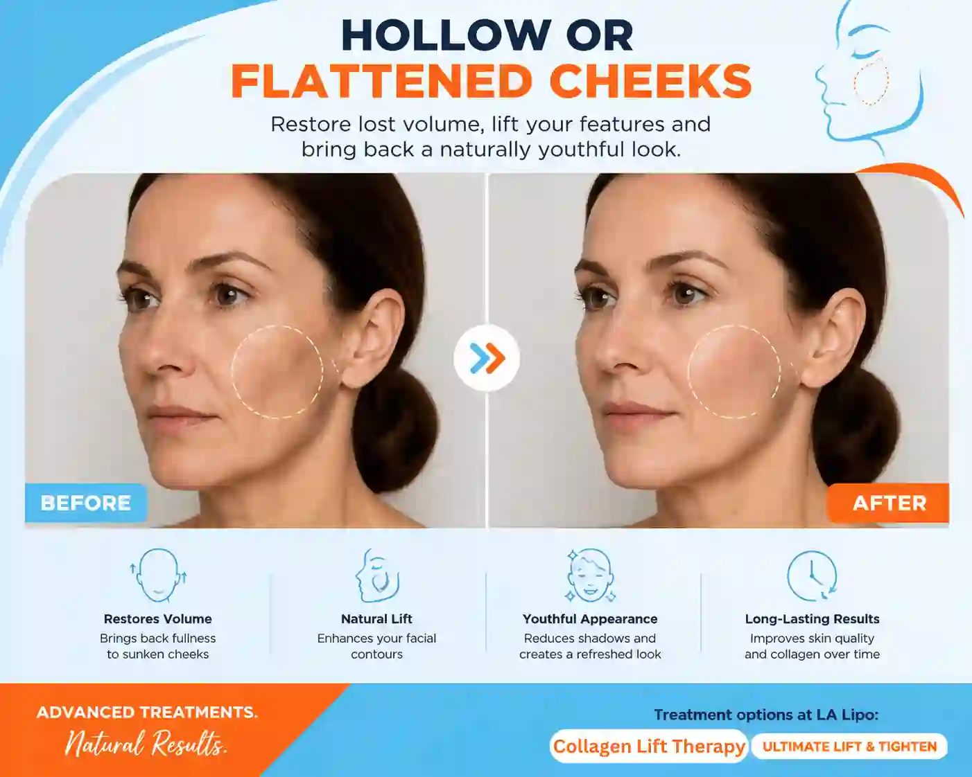 Sign #4: Hollow or Flattened Cheeks Wellingborough