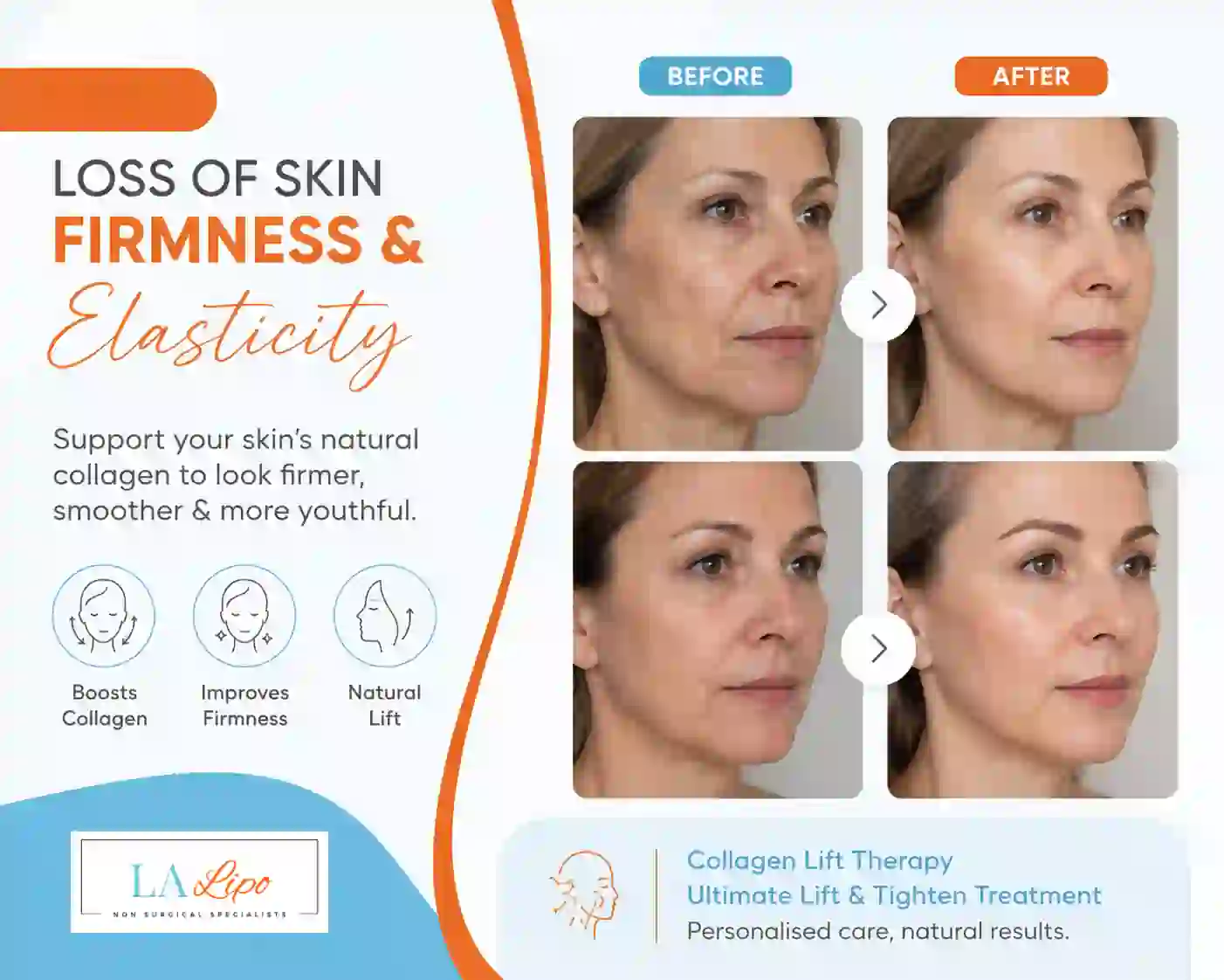 Sign #7: Loss of Skin Firmness and Elasticity Wellingborough